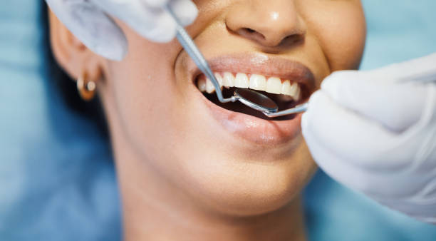 Best Knocked-Out Tooth (Avulsed Tooth) Treatment in Village Green, NY