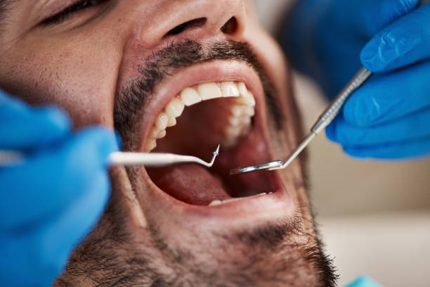 Best Emergency Care for Gum Disease in Village Green, NY