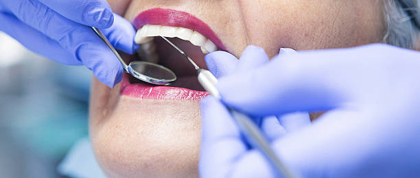 Best Emergency Wisdom Tooth Extraction in Village Green, NY